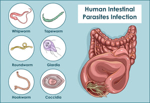 Parasite Detox Cleanse